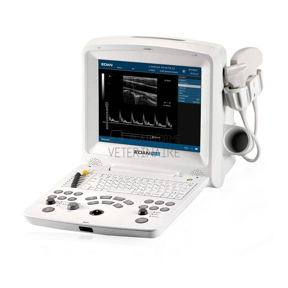 ECHOGRAPHE DOPPLER DUS 60 + 1 SONDE CONVEXE ET BATTERIE